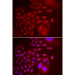 Anti-TRAPPC10 Antibody from Bioworld Technology (BS8431) - Antibodies.com