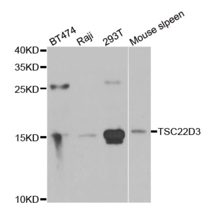 Anti-TSC22D3 Antibody from Bioworld Technology (BS8433) - Antibodies.com