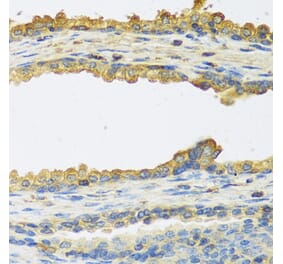 Anti-TSHB Antibody from Bioworld Technology (BS8434) - Antibodies.com