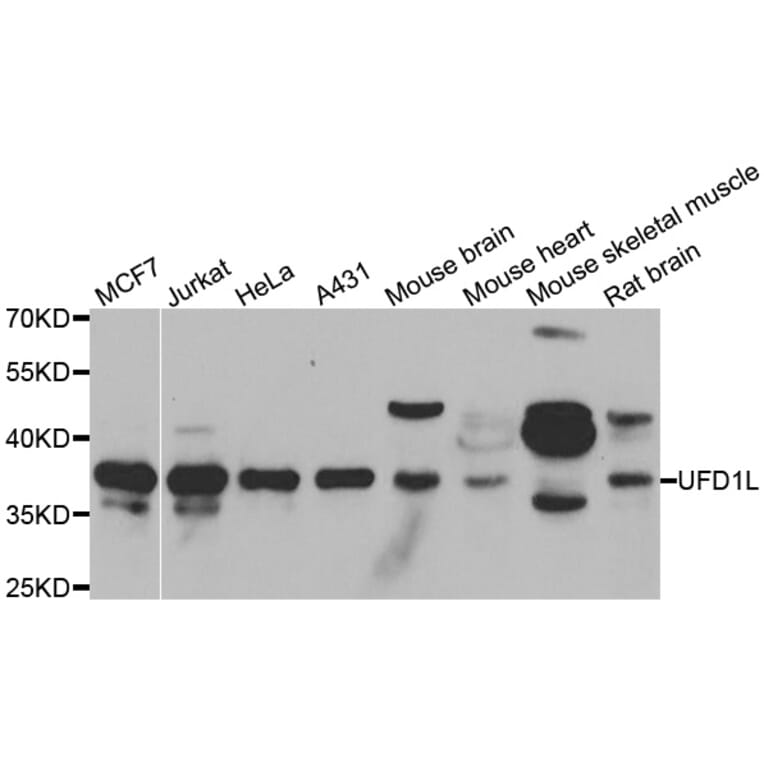 Anti-UFD1L Antibody from Bioworld Technology (BS8436) - Antibodies.com