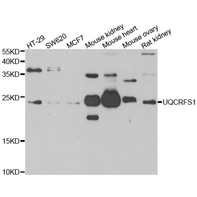 Anti-UQCRFS1 Antibody from Bioworld Technology (BS8437) - Antibodies.com