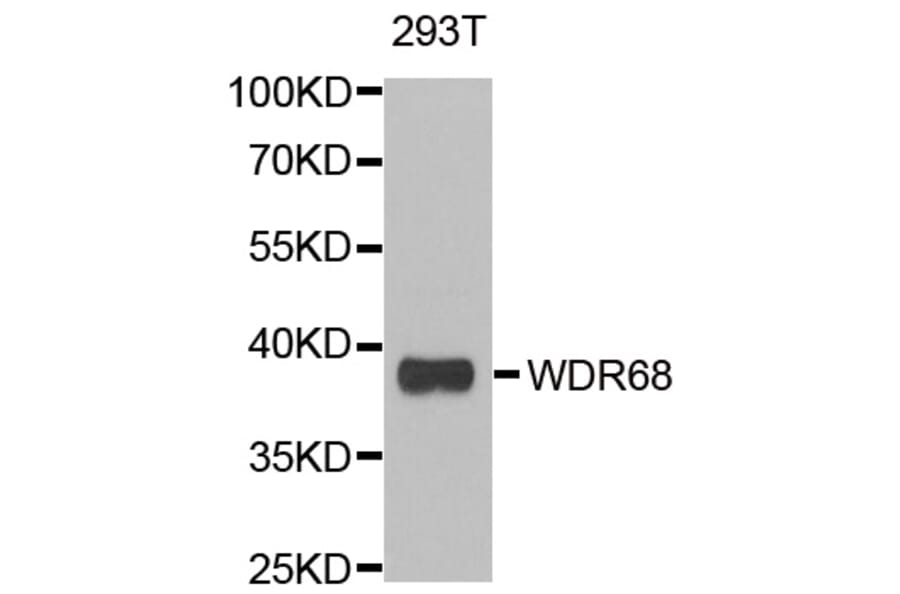 Anti-WDR68 Antibody from Bioworld Technology (BS8440) - Antibodies.com