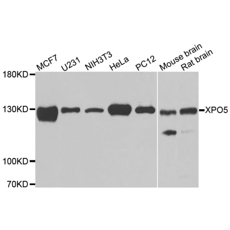 Anti-XPO5 Antibody from Bioworld Technology (BS8443) - Antibodies.com