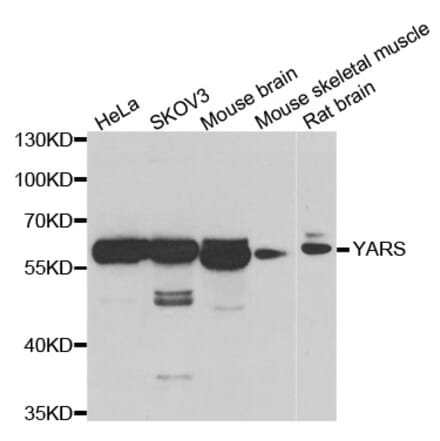 Anti-YARS Antibody from Bioworld Technology (BS8444) - Antibodies.com