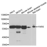Anti-YARS Antibody from Bioworld Technology (BS8444) - Antibodies.com