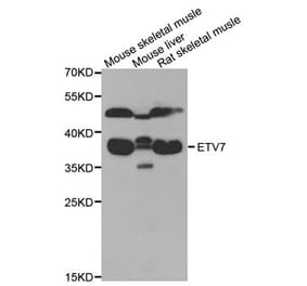 Anti-ETV7 Antibody from Bioworld Technology (BS8447) - Antibodies.com