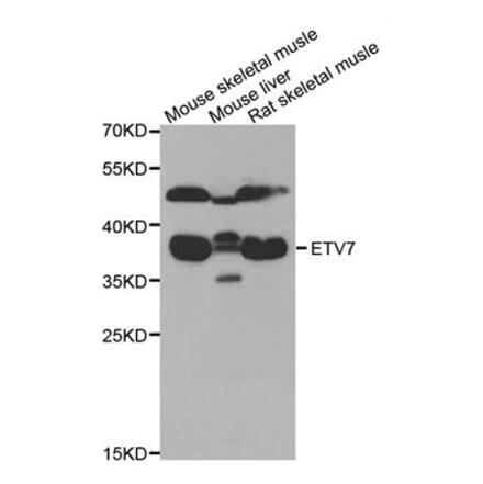 Anti-ETV7 Antibody from Bioworld Technology (BS8447) - Antibodies.com