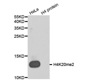 Anti-Histone H4 (Di-Methyl K20) Antibody from Bioworld Technology (BS8450) - Antibodies.com