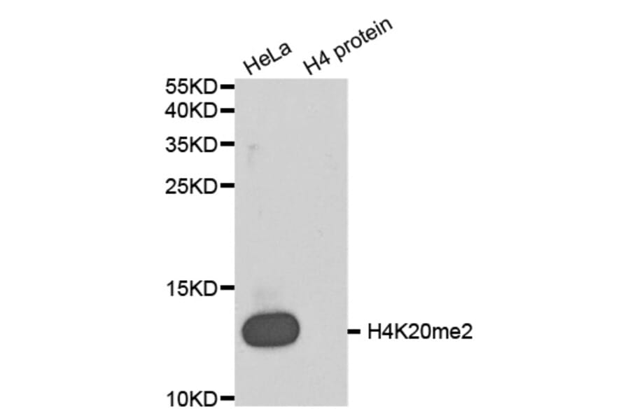 Anti-Histone H4 (Di-Methyl K20) Antibody from Bioworld Technology (BS8450) - Antibodies.com
