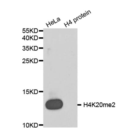 Anti-Histone H4 (Di-Methyl K20) Antibody from Bioworld Technology (BS8450) - Antibodies.com