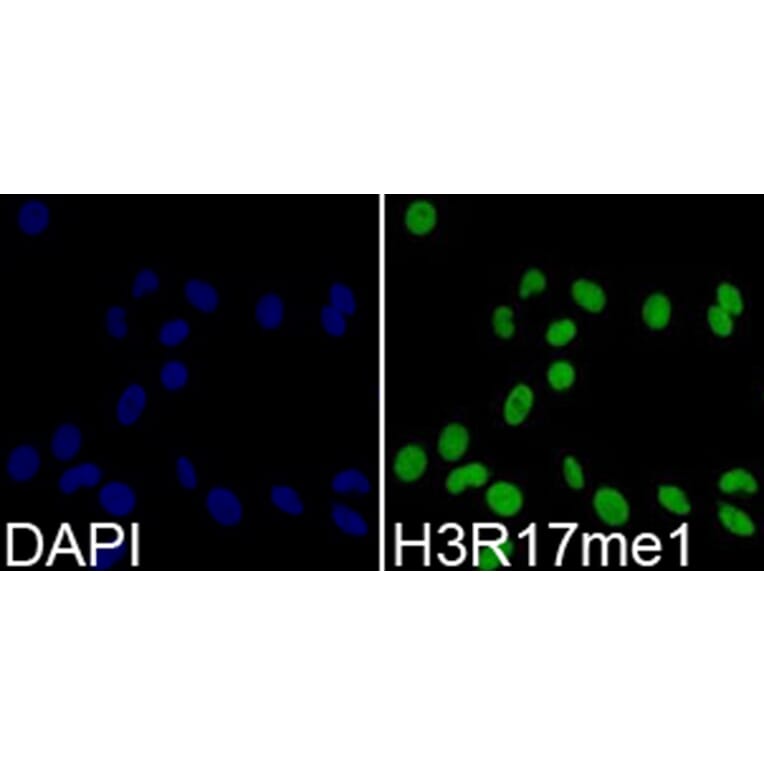 Anti-Histone H3 (Mono-Methyl R17) Antibody from Bioworld Technology (BS8451) - Antibodies.com