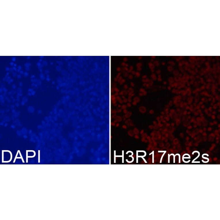 Anti-Histone H3 (sDi-Methyl R17) Antibody from Bioworld Technology (BS8452) - Antibodies.com