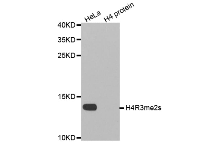 Anti-Histone H4 (sDi-Methyl R3) Antibody from Bioworld Technology (BS8455) - Antibodies.com