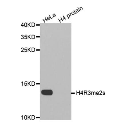 Anti-Histone H4 (sDi-Methyl R3) Antibody from Bioworld Technology (BS8455) - Antibodies.com