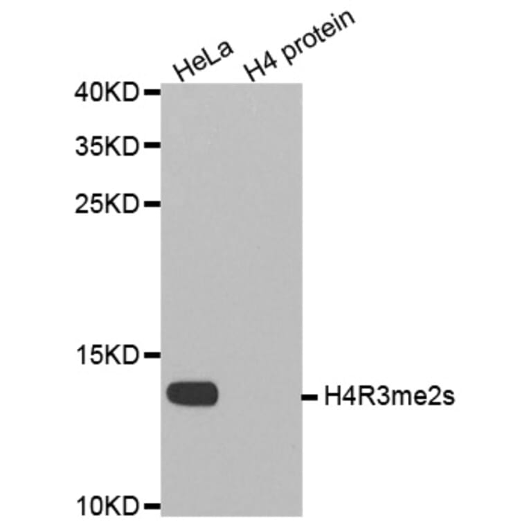 Anti-Histone H4 (sDi-Methyl R3) Antibody from Bioworld Technology (BS8455) - Antibodies.com