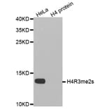 Anti-Histone H4 (sDi-Methyl R3) Antibody from Bioworld Technology (BS8455) - Antibodies.com