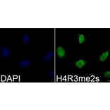 Anti-Histone H4 (sDi-Methyl R3) Antibody from Bioworld Technology (BS8455) - Antibodies.com