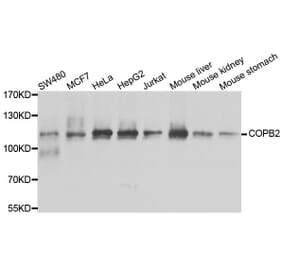 Anti-COPB2 Antibody from Bioworld Technology (BS8663) - Antibodies.com