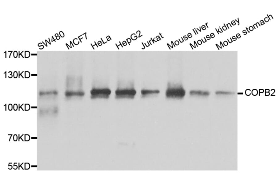 Anti-COPB2 Antibody from Bioworld Technology (BS8663) - Antibodies.com