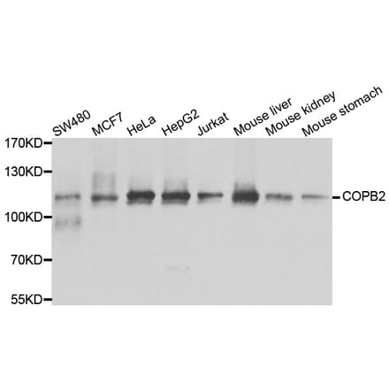 Anti-COPB2 Antibody from Bioworld Technology (BS8663) - Antibodies.com