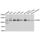 Anti-COPB2 Antibody from Bioworld Technology (BS8663) - Antibodies.com