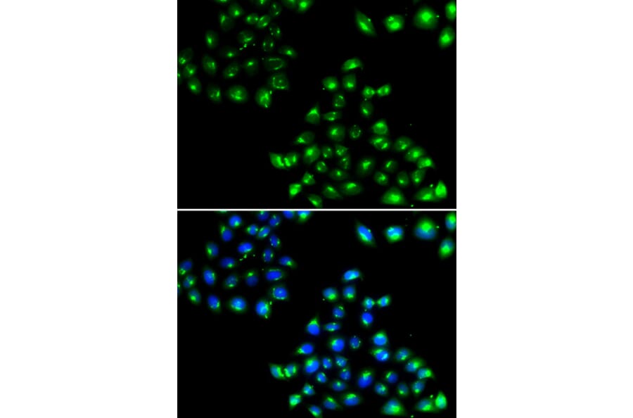 Anti-COPB2 Antibody from Bioworld Technology (BS8663) - Antibodies.com