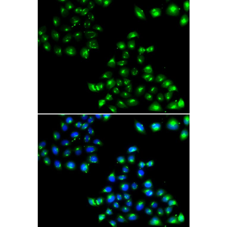 Anti-COPB2 Antibody from Bioworld Technology (BS8663) - Antibodies.com