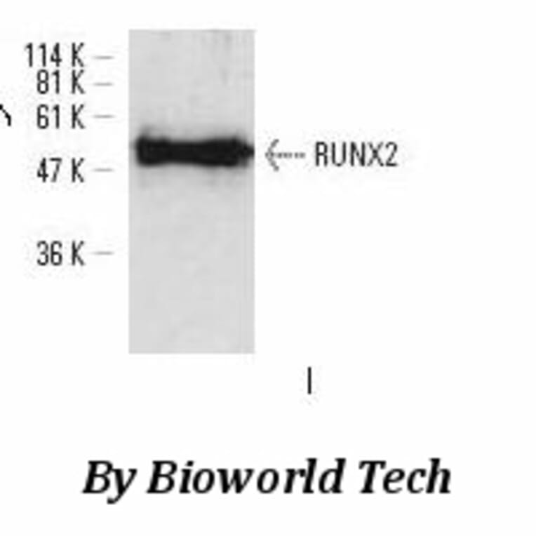 Anti-RUNX-2 (D198) Antibody from Bioworld Technology (BS8734) - Antibodies.com