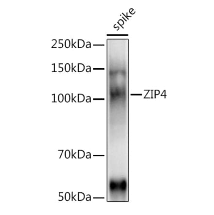 Western Blot - Anti-ZIP4 Antibody (A310000) - Antibodies.com