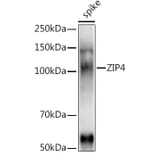 Western Blot - Anti-ZIP4 Antibody (A310000) - Antibodies.com
