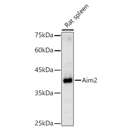 Western Blot - Anti-AIM2 Antibody (A310001) - Antibodies.com