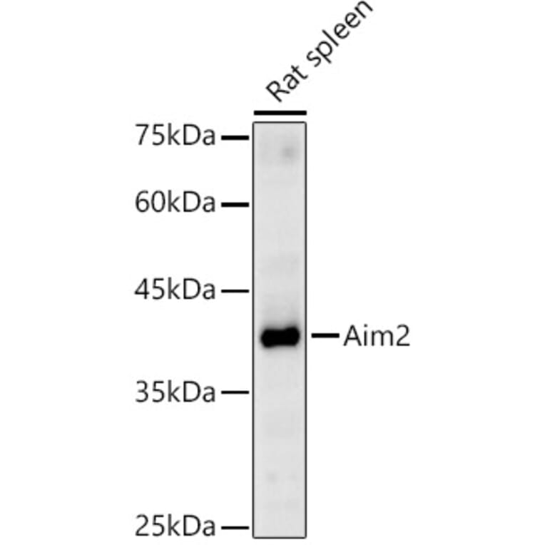 Western Blot - Anti-AIM2 Antibody (A310001) - Antibodies.com