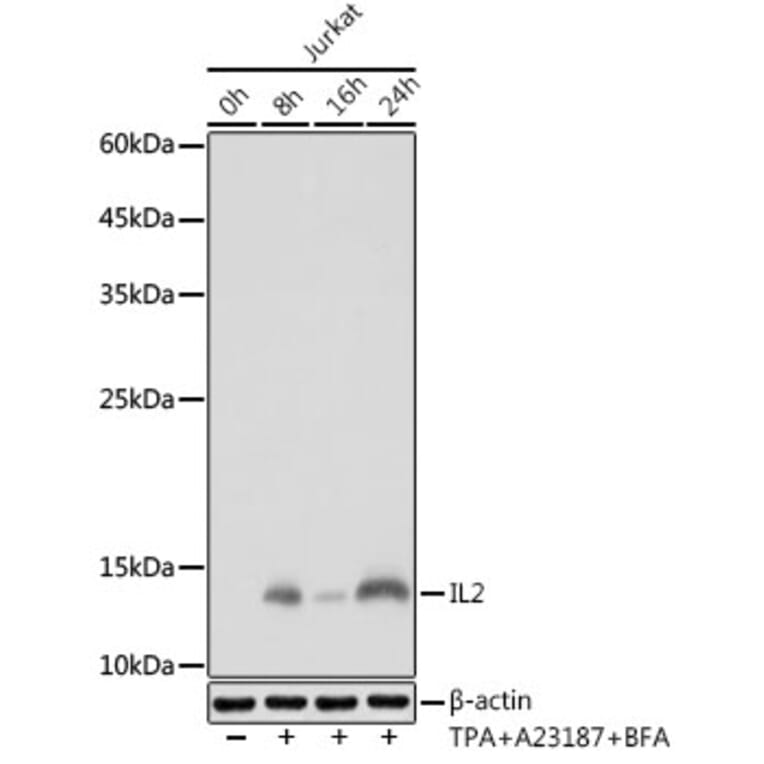 Western Blot - Anti-IL-2 Antibody [ARC5130-01] (A310010) - Antibodies.com