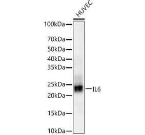 Western Blot - Anti-IL-6 Antibody (A310011) - Antibodies.com