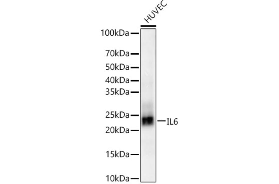 Western Blot - Anti-IL-6 Antibody [ARC5093-01] (A310011) - Antibodies.com