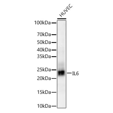 Western Blot - Anti-IL-6 Antibody [ARC5093-01] (A310011) - Antibodies.com