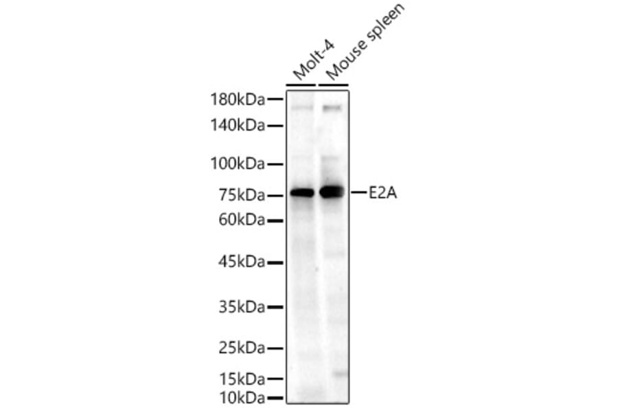 Western Blot - Anti-TCF3/E2A Antibody (A310013) - Antibodies.com