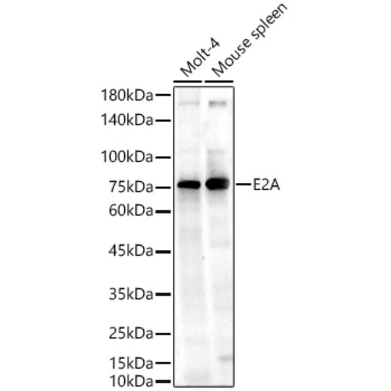Western Blot - Anti-TCF3/E2A Antibody (A310013) - Antibodies.com