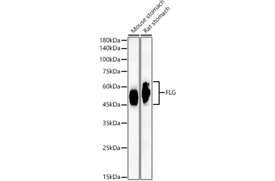 Western Blot - Anti-Filaggrin Antibody [ARC60254] (A310014) - Antibodies.com