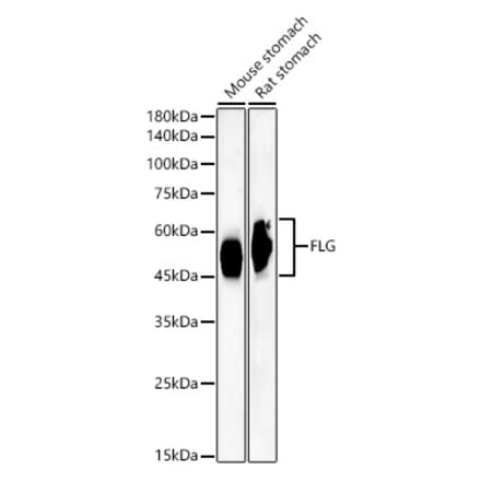 Western Blot - Anti-Filaggrin Antibody [ARC60254] (A310014) - Antibodies.com