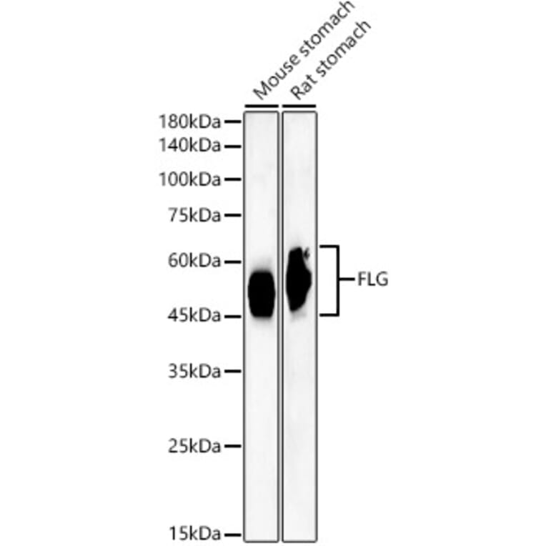 Western Blot - Anti-Filaggrin Antibody [ARC60254] (A310014) - Antibodies.com