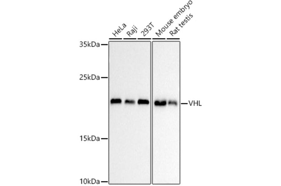 Western Blot - Anti-VHL Antibody [AMC0442] (A310017) - Antibodies.com