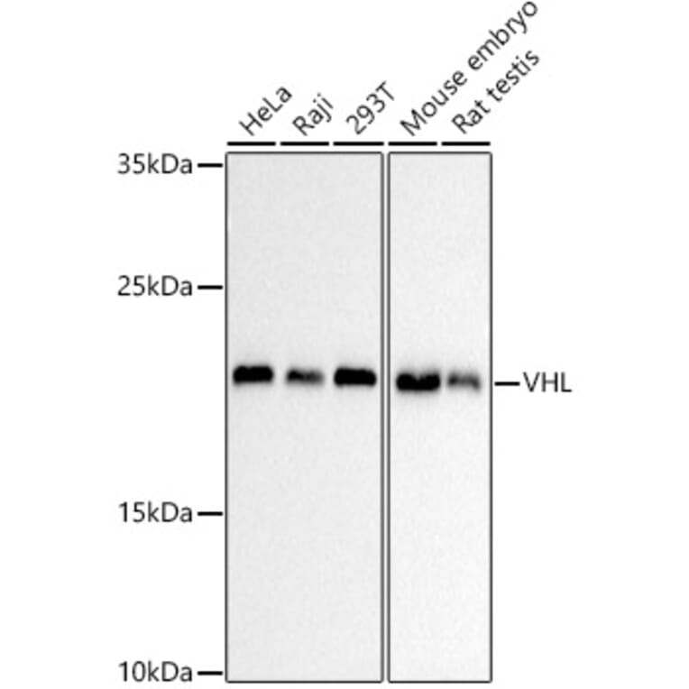 Western Blot - Anti-VHL Antibody [AMC0442] (A310017) - Antibodies.com
