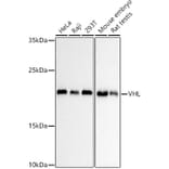 Western Blot - Anti-VHL Antibody [AMC0442] (A310017) - Antibodies.com
