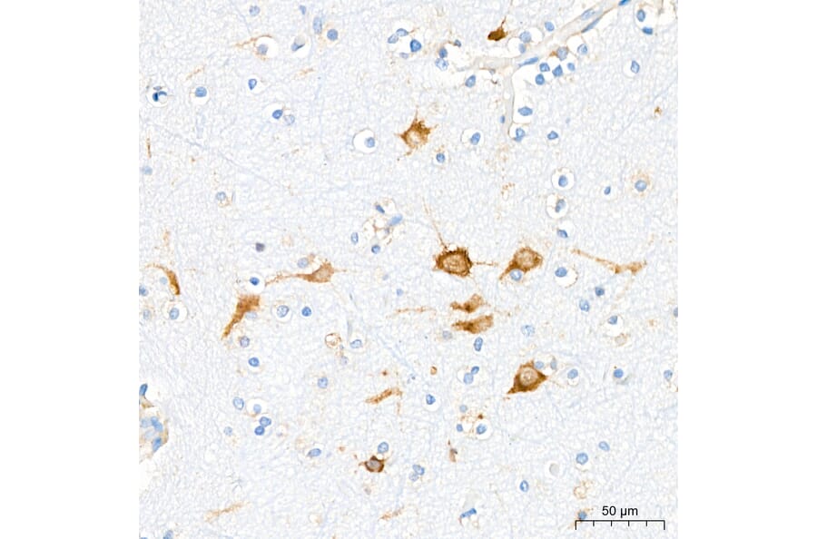 Immunohistochemistry - Anti-VHL Antibody [AMC0442] (A310017) - Antibodies.com