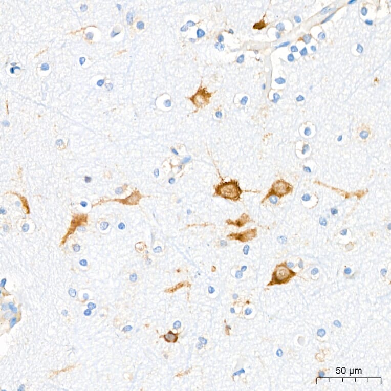 Immunohistochemistry - Anti-VHL Antibody [AMC0442] (A310017) - Antibodies.com