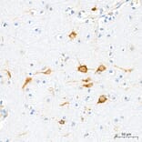 Immunohistochemistry - Anti-VHL Antibody [AMC0442] (A310017) - Antibodies.com