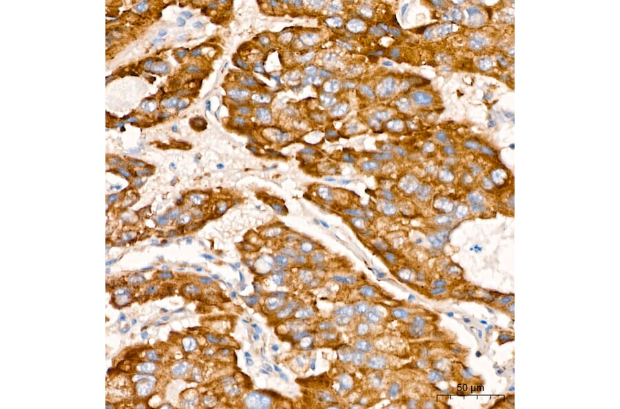 Immunohistochemistry - Anti-VHL Antibody [AMC0442] (A310017) - Antibodies.com