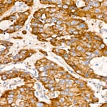 Immunohistochemistry - Anti-VHL Antibody [AMC0442] (A310017) - Antibodies.com