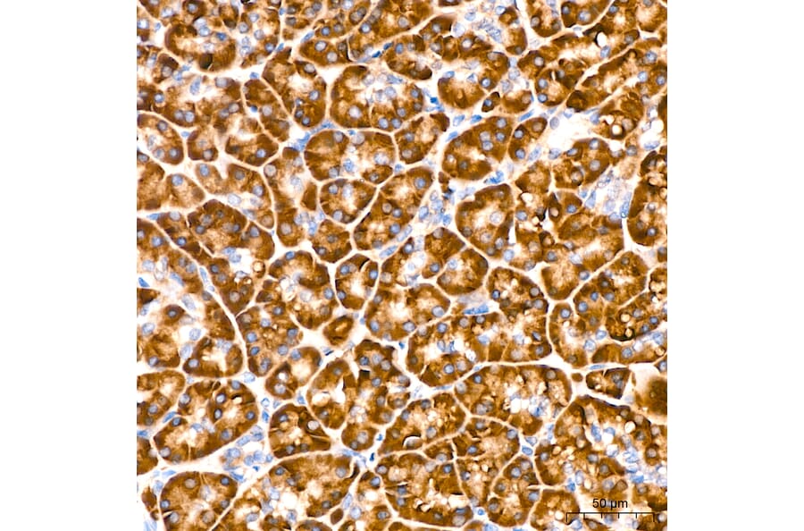 Immunohistochemistry - Anti-VHL Antibody [AMC0442] (A310017) - Antibodies.com